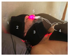 Bundle of 5 - Maximum Glymphatic Coverage